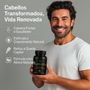 CapilVita – Suplemento Anticaída 💊 | Fortalece y Estimula el Crecimiento del Cabello 🌱 (30 cápsulas)